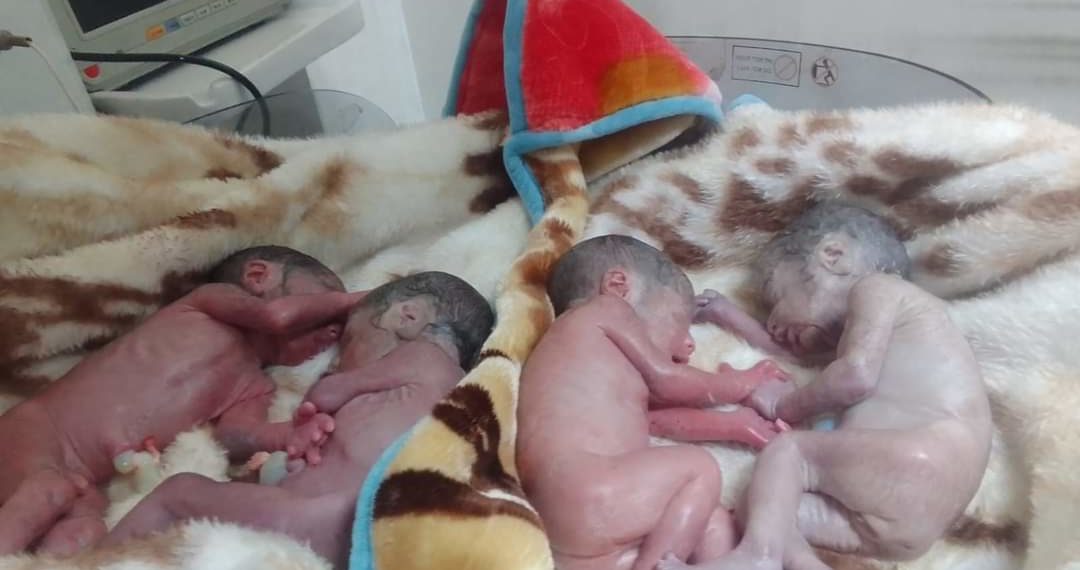 Kupwara Woman Gives Birth to Quadrapultes
