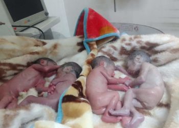 Kupwara Woman Gives Birth to Quadrapultes