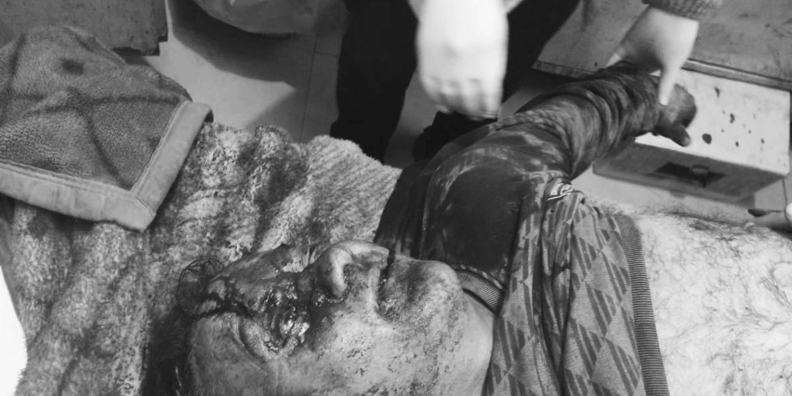 Man dies in Chanderkote road accident