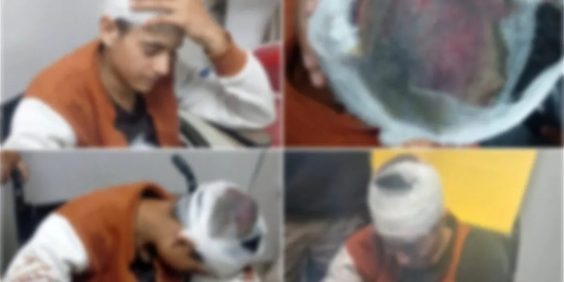 18-Year-Old Kashmiri Shawl Seller Brutally Assaulted in Uttarakhand