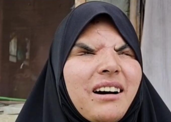 Govt Sanctions ₹41.16 Lakh for Pellet Victim Insha Mushtaq’s LPG Distributorship: Satish Sharma