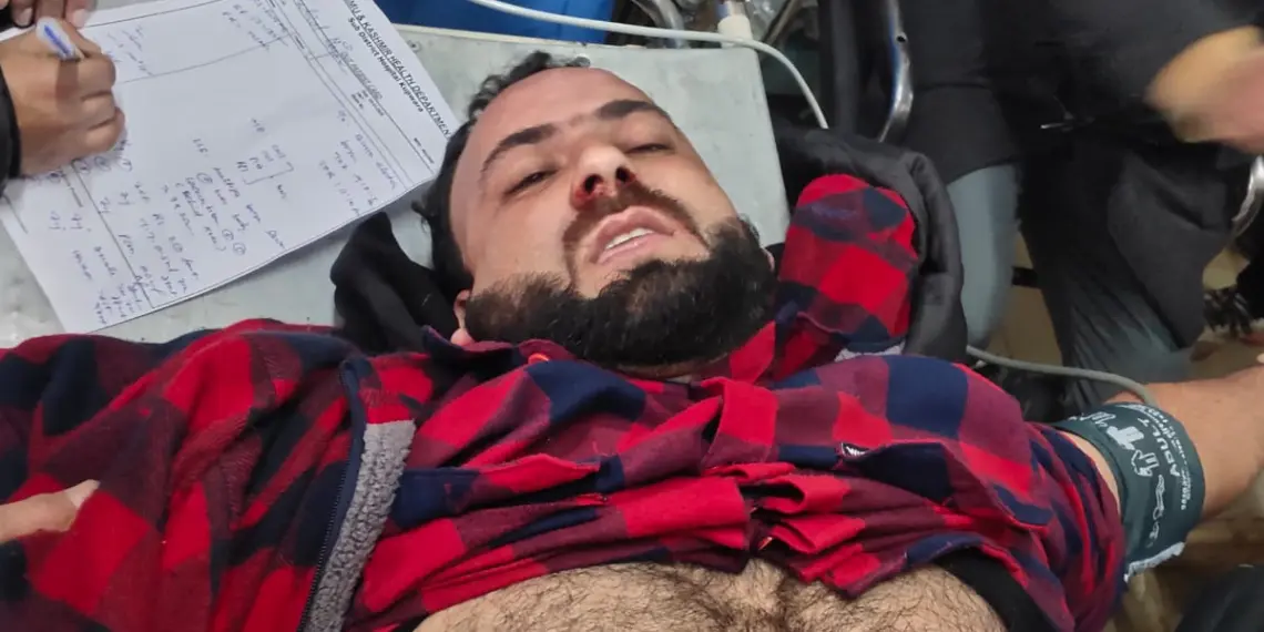 Negligence by electricity Dept. leaves 25-year-old critical in Kupwara