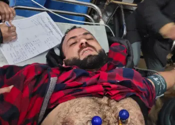 Negligence by electricity Dept. leaves 25-year-old critical in Kupwara