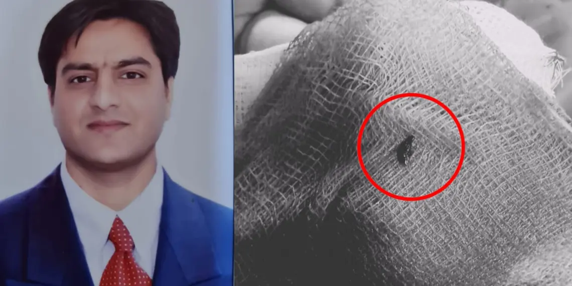 Kashmiri Doctor Performs Rare Brain Surgery, Saves 77-Year-Old Woman in Srinagar