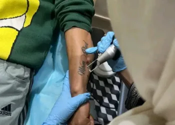 Free Tattoo Removal Camp by Ehsaas Foundation and Revive Aesthetics Concludes Successfully in Srinagar