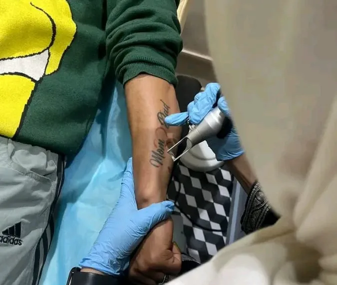 Free Tattoo Removal Camp by Ehsaas Foundation and Revive Aesthetics Concludes Successfully in Srinagar