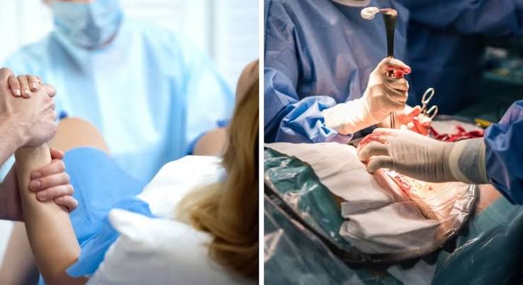 90% of Deliveries In J&K Private Hospitals are C-Sections: Report