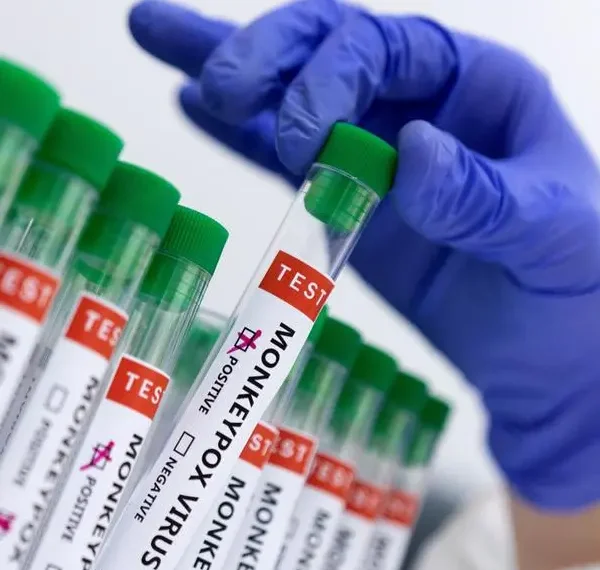 Mpox confirmed in man who travelled from country experiencing disease spread: Govt