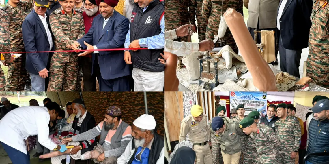 Indian Army Organises Artificial Limb Camp at Kalapahar Brigade, Uri; 243 Beneficiaries Receive Assistive Aids