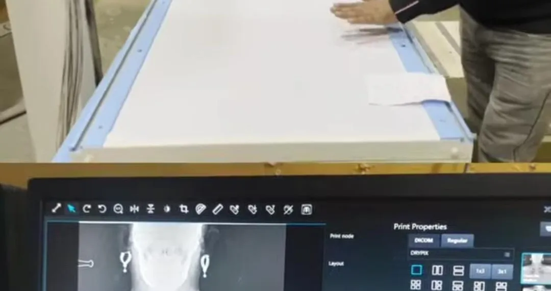 SDH Sopore Equipped with State-of-the-Art DR Digital Radiography X-Ray Machine