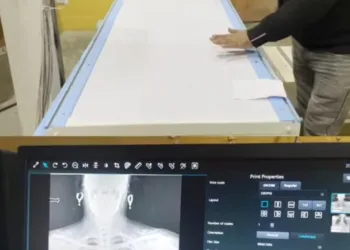 SDH Sopore Equipped with State-of-the-Art DR Digital Radiography X-Ray Machine