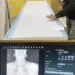 SDH Sopore Equipped with State-of-the-Art DR Digital Radiography X-Ray Machine